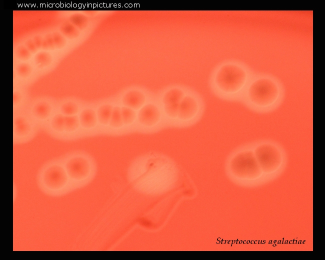 Streptococcus agalactiae colony morphology. Colonies of group B beta ...